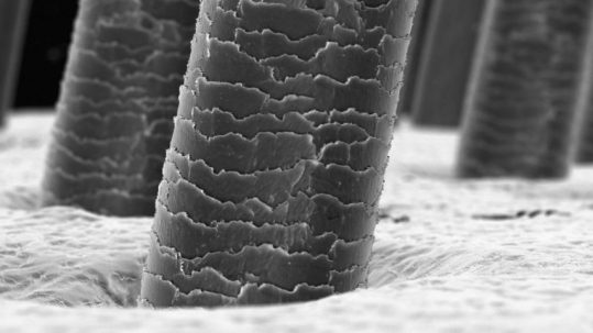 folículos piloso. Frena la caída del cabello en La Clinica Capilar Velazquez