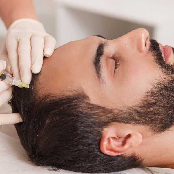 finasteride vs minoxidil en la Clinica Capilar Velazquez en Madrid