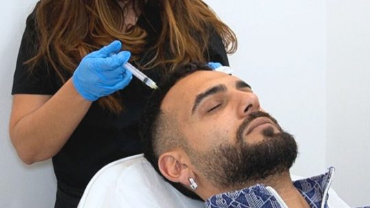 Tratamiento Capilar Hombre Manuel Cortes en Clínica Capilar Velázquez