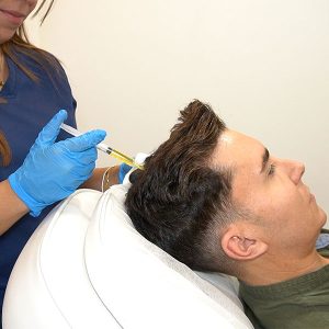 PRP Capilar tratamiento Capilar con Omar Suarez en Clinica Capilar Velazquez