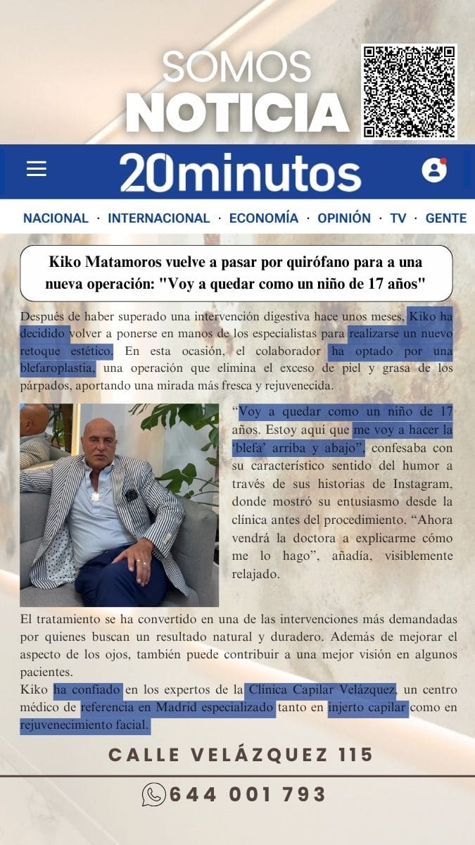 Clínica Capilar Velazquez es noticia con Kiko Matamoro y su blefaroplastia en 20 Minutos
