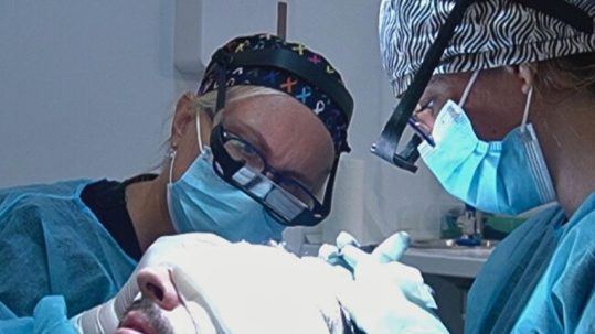 Injerto Capilar en Clínica Velazquez Madrid