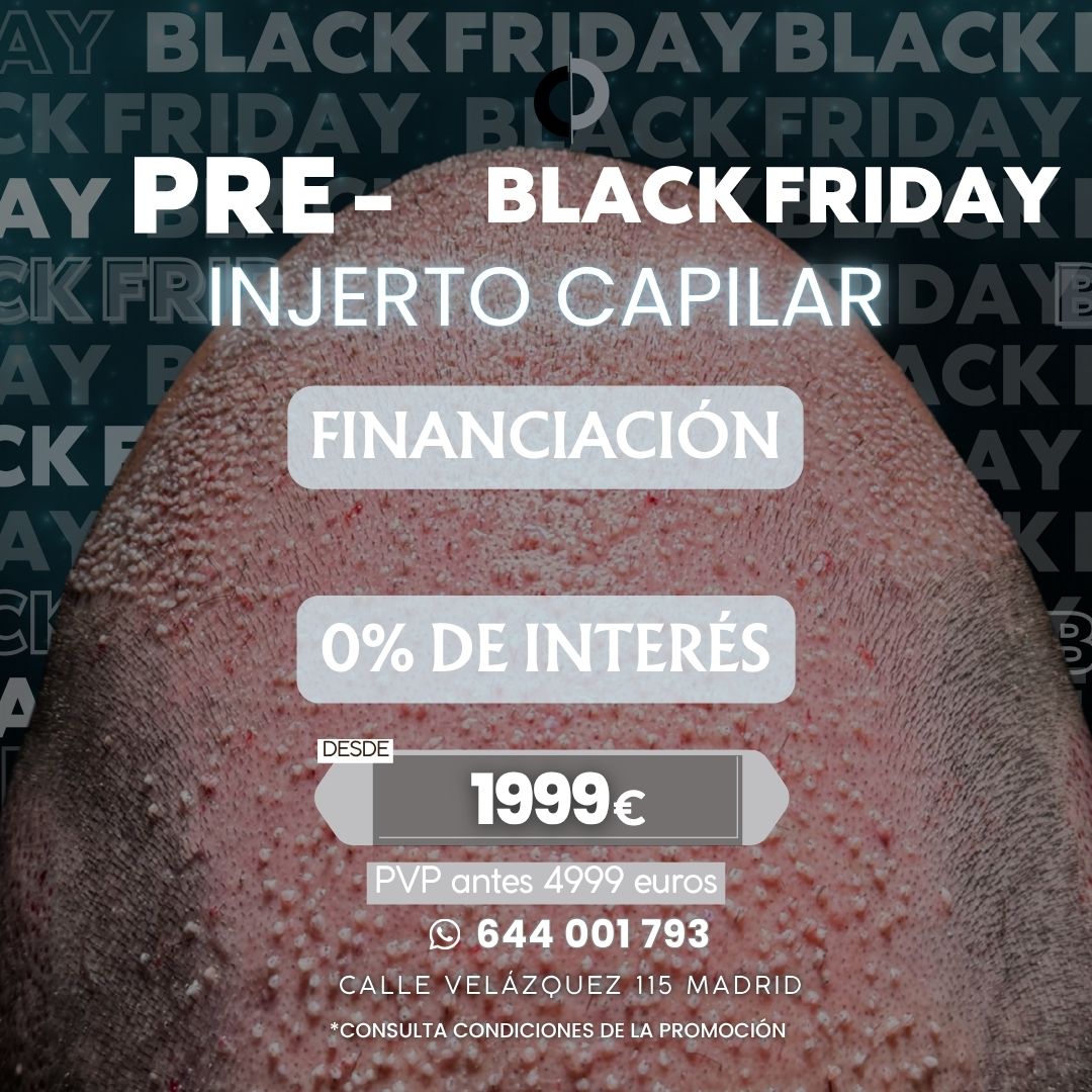 Clinica Capilar Velazquez Black Friday