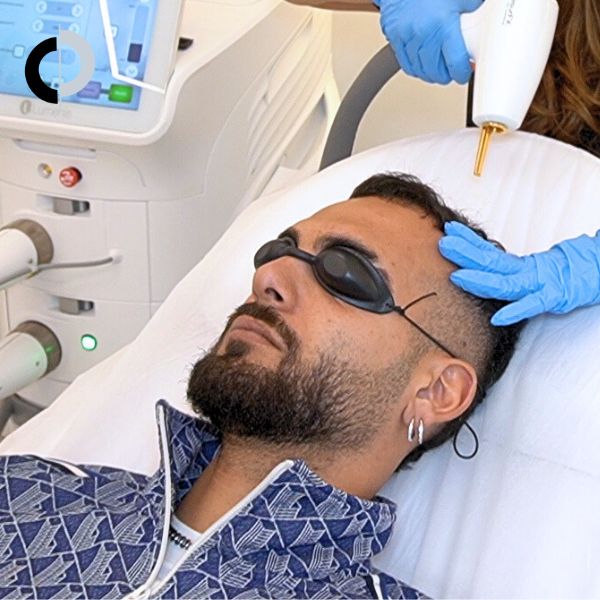 Laser Capilar Resurhair con Manuel Cortes en la Clínica Capilar Velázquez