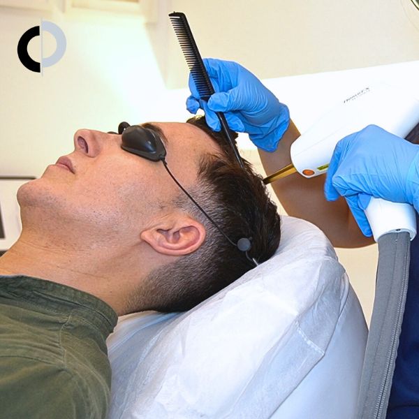 Láser Capilar Madrid con Omar Suárez. Paciente Clinica Capilar Velázquez Láser Capilar Madrid con Omar Suárez. Paciente Clinica Capilar Velázquez