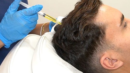 Omar Tratamiento PRP Capilar Grooming Masculino