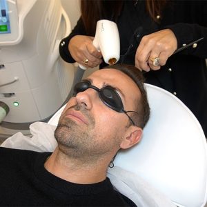 Rafa Mora tratamiento láser. Paciente Clínica Capilar Clínica Velázquez. Grooming Masculino