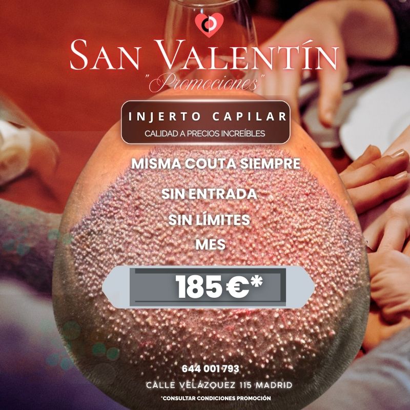 Clínica capilar Madrid Velazquez