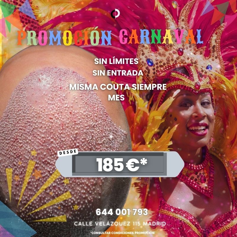 Clínica capilar Madrid Velázquez