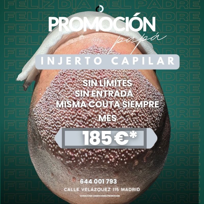 clinica capilar velazquez banner movil